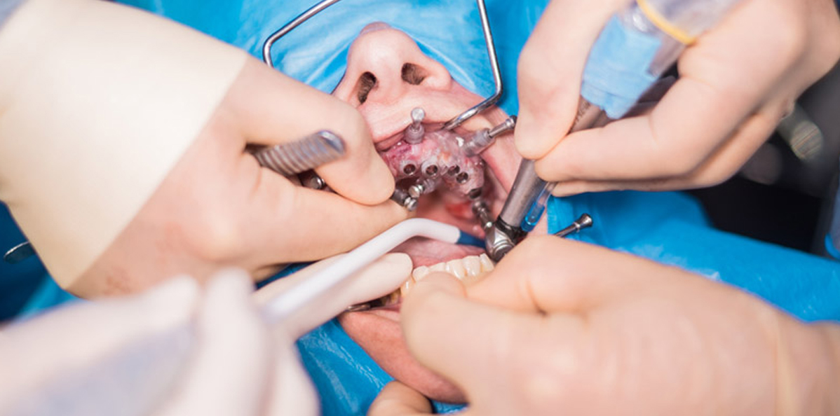 Minor-Surgeries