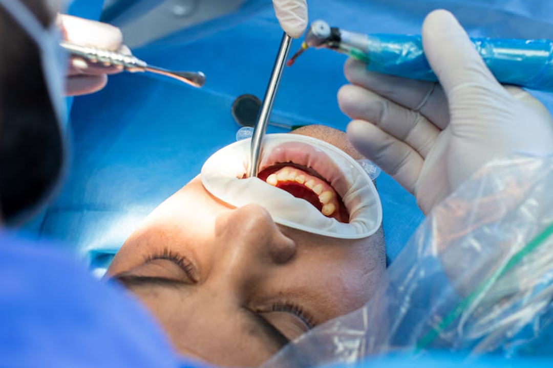 Minor-Surgeries