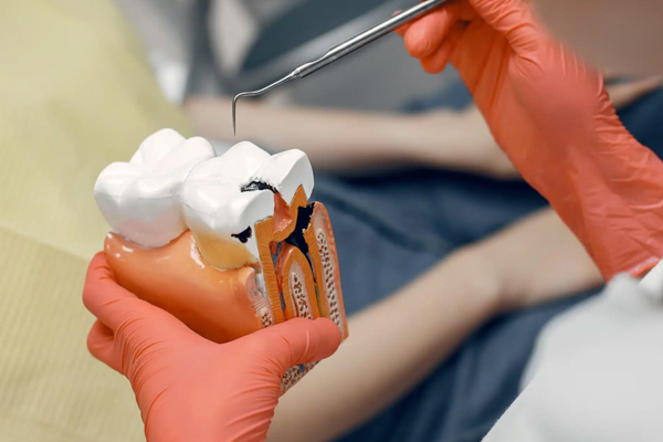 Advanced Root Canal Treatment with Digital Technology at Kundra Dental Clinic