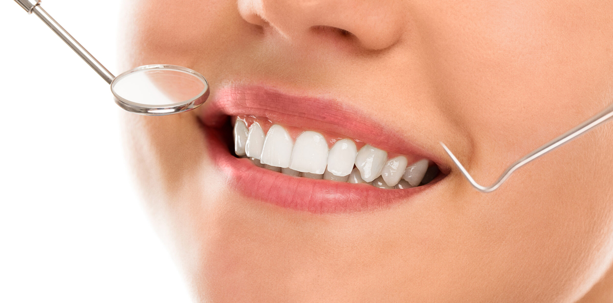 Smile-Designing