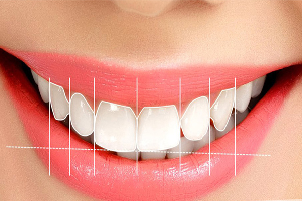 Transform Your Look with Smile Designing at Kundra Dental Clinic
