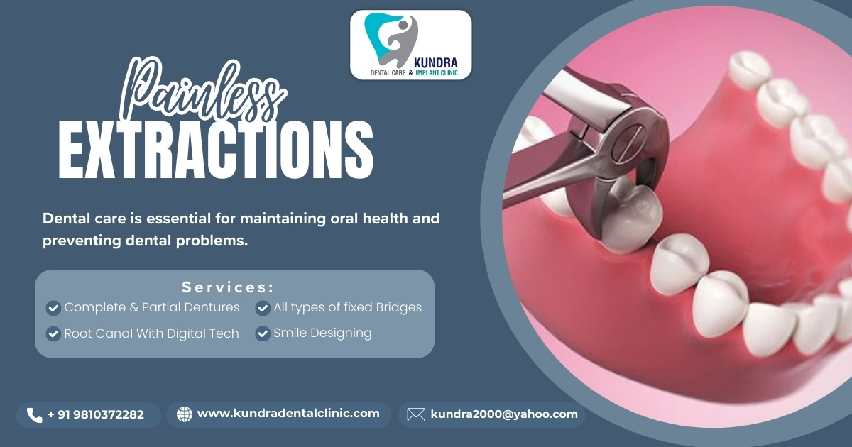 Painless Tooth Extraction In Delhi – Safe & Comfortable Dental Care at Kundra Dental Care & Implant Clinic