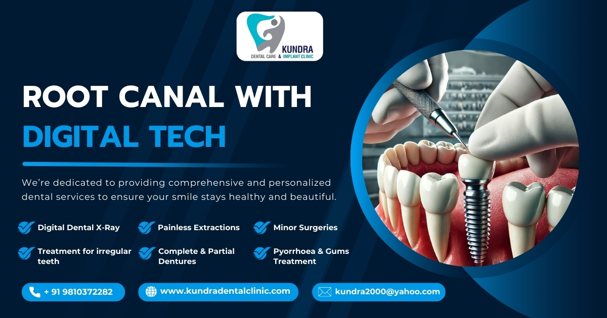 Root Canal Treatment: The Key to Saving Your Natural Smile