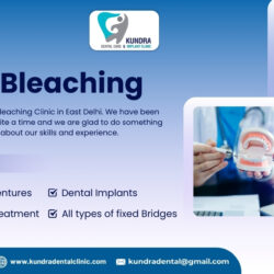 teeth bleaching near me