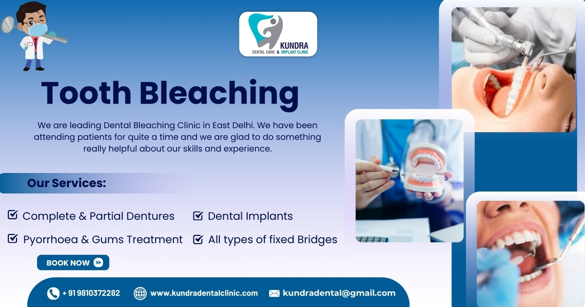 Why Choose Teeth Bleaching Near Me at Kundra Dental Care & Implant Clinic