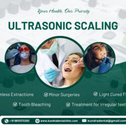 Ultrasonic Teeth Cleaning Dentist in Delhi – Kundra Dental