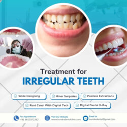 Treatment for Irregular Teeth
