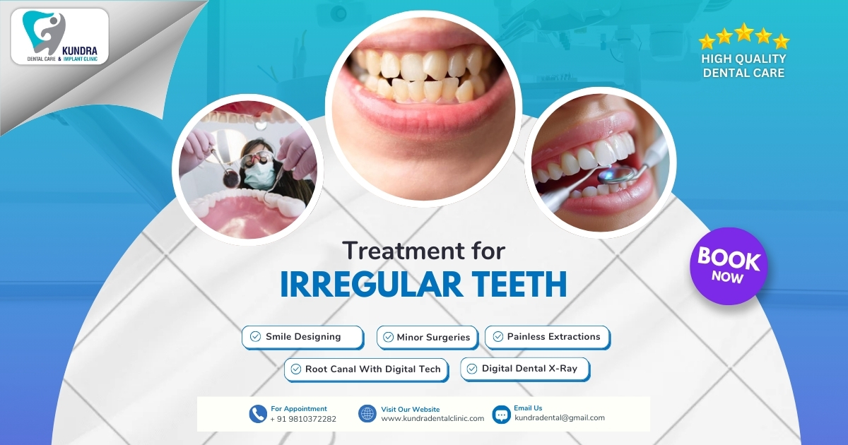 Straighten Your Smile with Expert Treatment for Irregular Teeth in Delhi