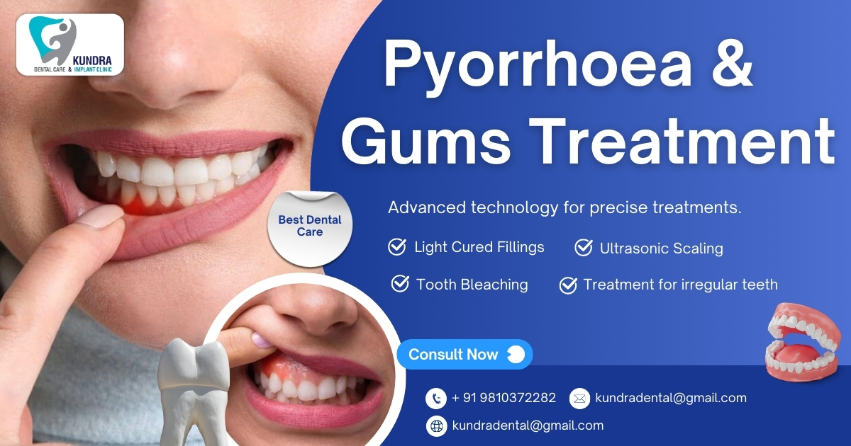 Pyorrhoea Treatment: Effective Dental Care at Kundra Dental Care & Implant Clinic