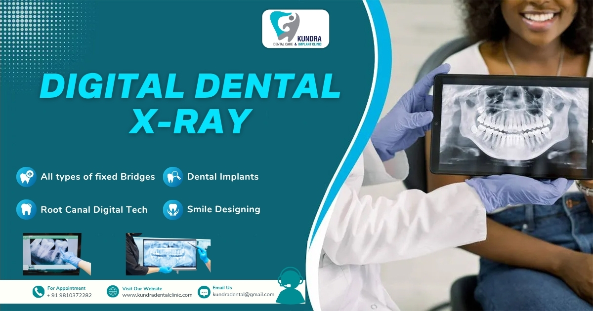 Discover the Most Trusted Dental X Ray Centre Near Me – Kundra Dental Clinic