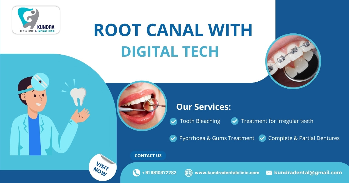 Top-Rated Endodontic Center Near Me – Kundra Dental Clinic Delhi