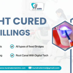 laser cavity filling near me