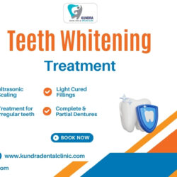 smile whitening