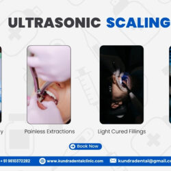 ultrasonic dental cleaning near me