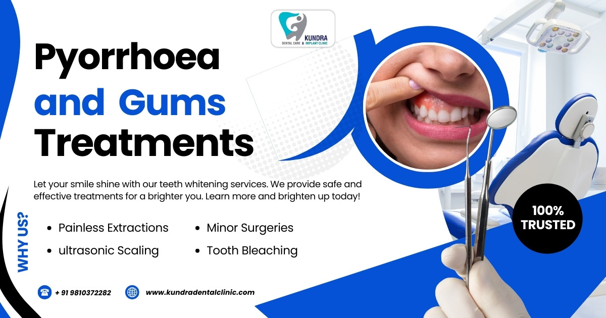 Transform Your Smile with the Best Gum Dentist in Delhi