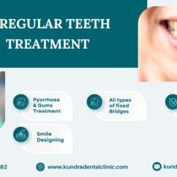 fix irregular tooth