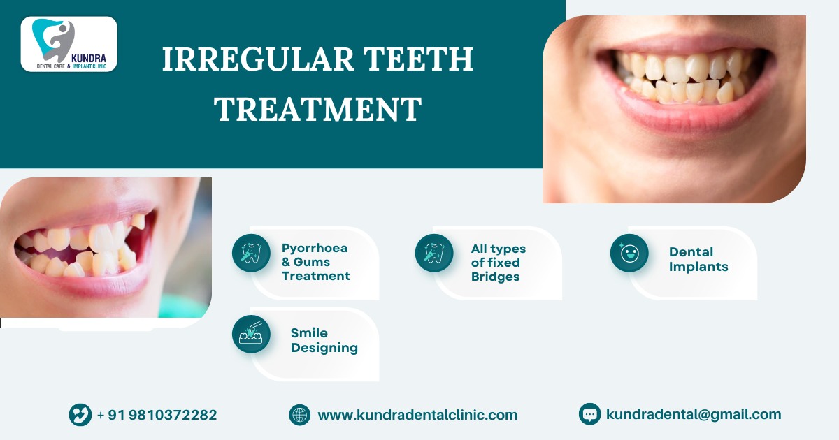 Transform Your Smile with Expert Care: Fix Irregular Tooth at Kundra Dental Clinic